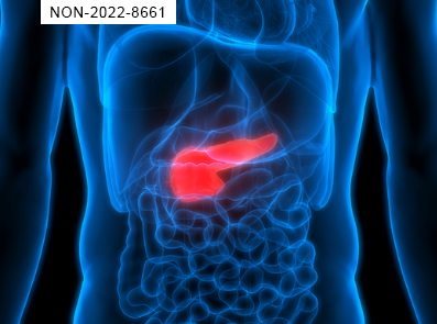 Le caratteristiche dell'Insufficienza Pancreatica Esocrina (IPE)