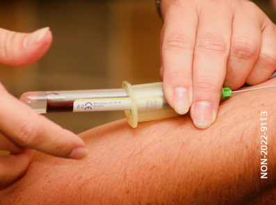 Il colesterolo è una sostanza simile ai grassi ed è prodotta dall’organismo, oppure assunta con l’alimentazione.